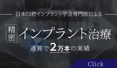 日本口腔インプラント学会専門医による 精密 インプラント治療 トータル症例7325本の実績