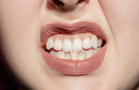 歯ぎしり・食いしばりに多い症状